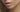 This is how positively hyaluronic acid affects your lips